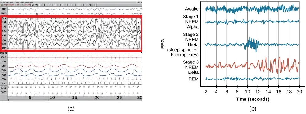 Polysonograph a shows the pattern of delta waves, which are low frequency and high amplitude. Delta waves are found mostly in stage 3 of sleep. Chart b shows brainwaves at various stages of sleep, with stage 3 highlighted.