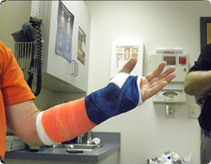 Arm in cast