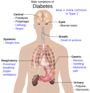 body with listing of symptoms of Diabetes