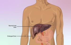 normal and enlarged liver