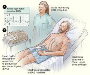 nurse doing ECG