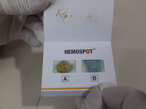 test for blood in a fecal sample, card for analysis