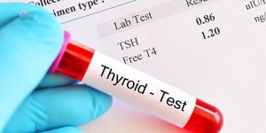 blood for thyroid test