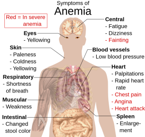 body with symptoms of anemia