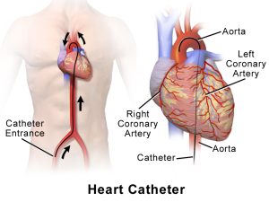 Cardiac catheterization image