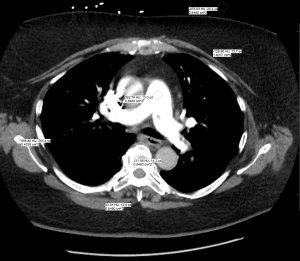 image of Computed tomography