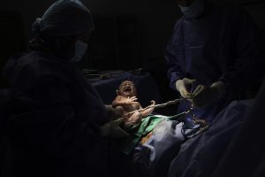 Baby being born via caesarian section