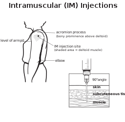 Diagram showing an intramuscular injection site on a shoulder shaded to show the deltoid muscle. The diagram also shows the level of armpit, the acromion process (bony prominence above the deltoid) and the elbow. There is a second diagram showing a syringe at a 90 degree angle penetrating the skin, subcutaneous tissue and muscle.