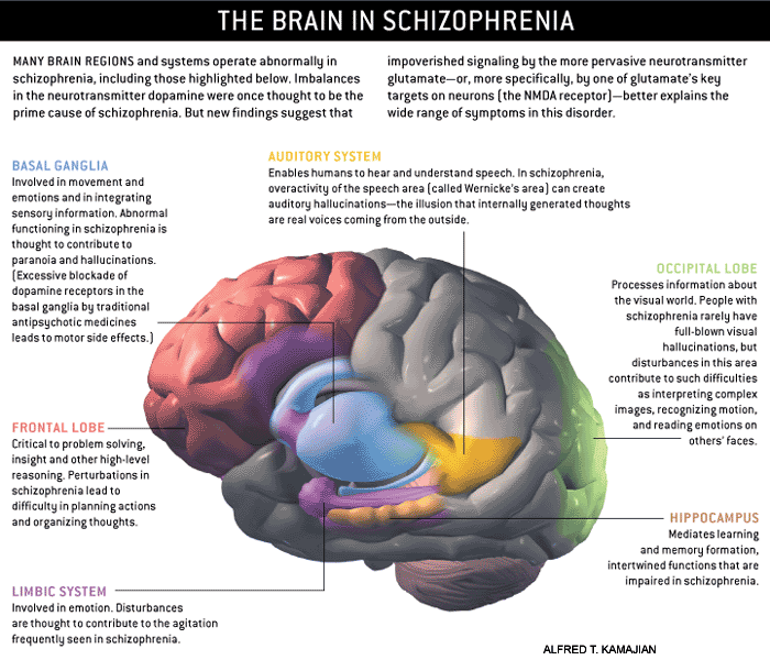 Detailed diagram of the brain and the areas that can be impacted by schizophrenia, including the basal ganglia, auditory system, occipital lobe, hippocampus, limbic system and frontal lobe