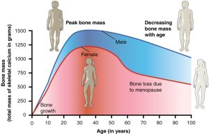 Chart correlating bone mass in total mass of skeletal calcium in grams with age. Female peak mass is around 30 and male peak mass is in the mid to late forties. Chart shows how women lose bone mass faster than men.