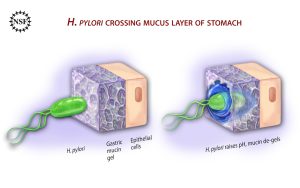 Illustration of ulcer-causing bacterium (H. Pylori) crossing the mucus layer of the stomach