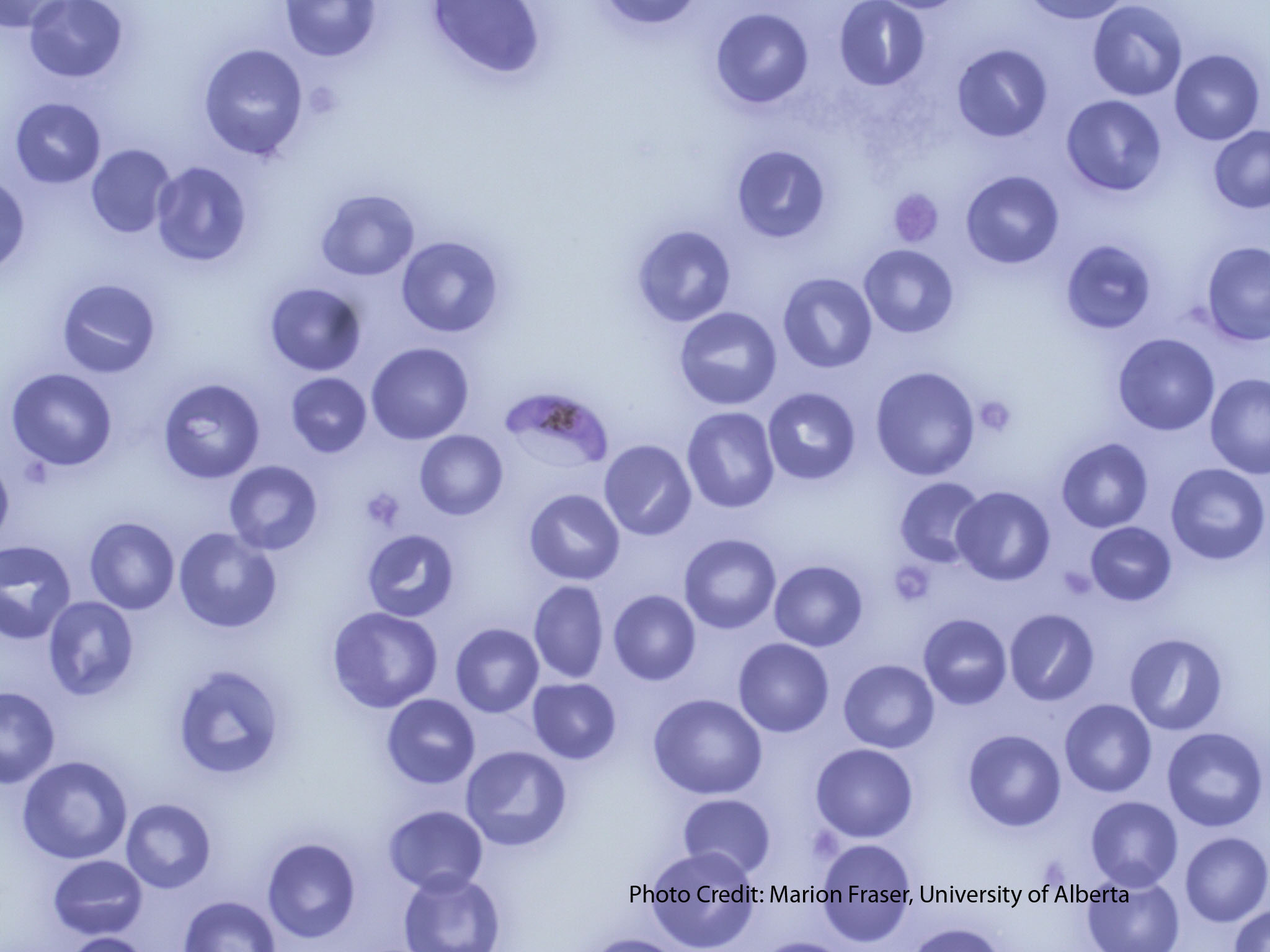 Microbiología-Bioanalisis - Plasmodium falciparum trophozoites. ✓Does not  enlarge red blood cells unlike Plasmodium vivax. ✓Small rings (1/5 diameter  red blood cells). ✓Multiple rings in a single cell. ✓Parasite all types of  red