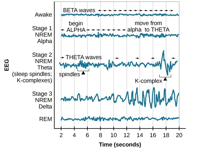 "A graph has a y-axis labeled “EEG” and an x-axis labeled “time (seconds.) Plotted along the y-axis and moving upward are the stages of sleep. First is REM, followed by Stage 3 NREM Delta, Stage 2 NREM Theta (sleep spindles; K-complexes), Stage 1 NREM Alpha, and Awake. Charted on the x axis is Time in seconds from 2–20 in 2 second intervals. Each sleep stage has associated wavelengths of varying amplitude and frequency. Relative to the others, “awake” has a very close wavelength and a medium amplitude. Stage 1 is characterized by a generally uniform wavelength and a relatively low amplitude which doubles and quickly reverts to normal every 2 seconds. Stage 2 is comprised of a similar wavelength as stage 1. It introduces the K-complex from seconds 10 through 12 which is a short burst of doubled or tripled amplitude and decreased wavelength. Stage 3 has a more uniform wave with gradually increasing amplitude. Finally, REM sleep looks much like stage 2 without the K-complex.