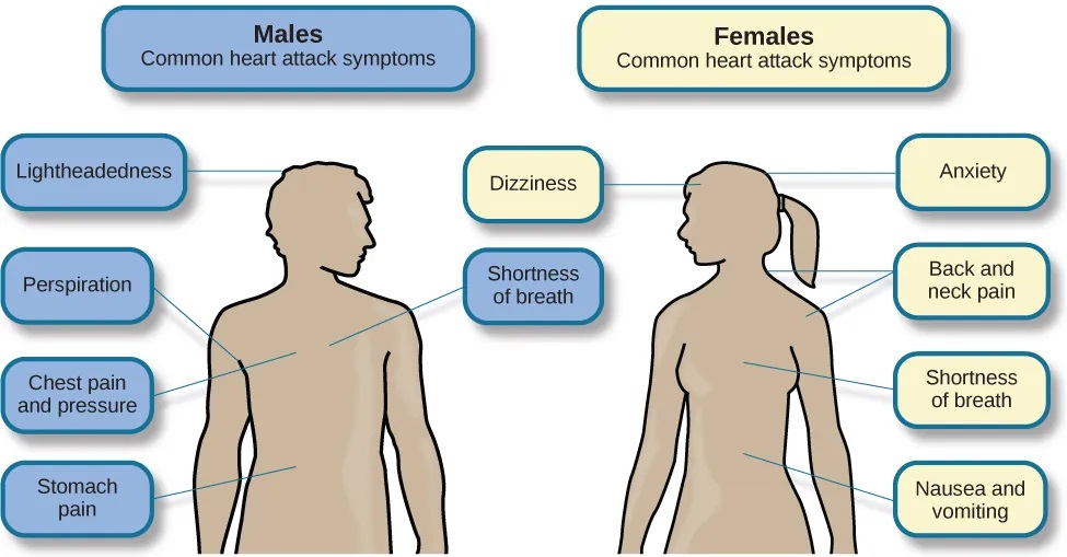 figure showing outlines of the male and female bodies indicates common heart attack symptoms for each sex. For males, these include lightheadedness, perspiration, chest pain and pressure, stomach pain, and shortness of breath. For females, these include dizziness, anxiety, back and neck pain, shortness of breath, nausea and vomiting.